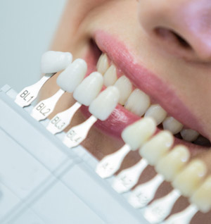 A close-up of a person's smile with a dental shade guide held up against their teeth. The guide features various numbered white tooth samples used to match the color for veneers or whitening treatments.